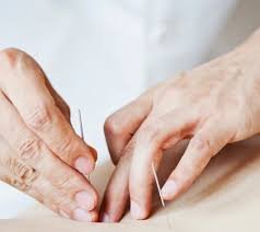 acupuncturist in lahore