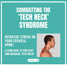 tech neck syndrome