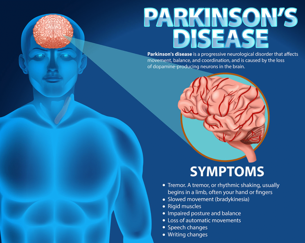 Parkinson physiotherapy program